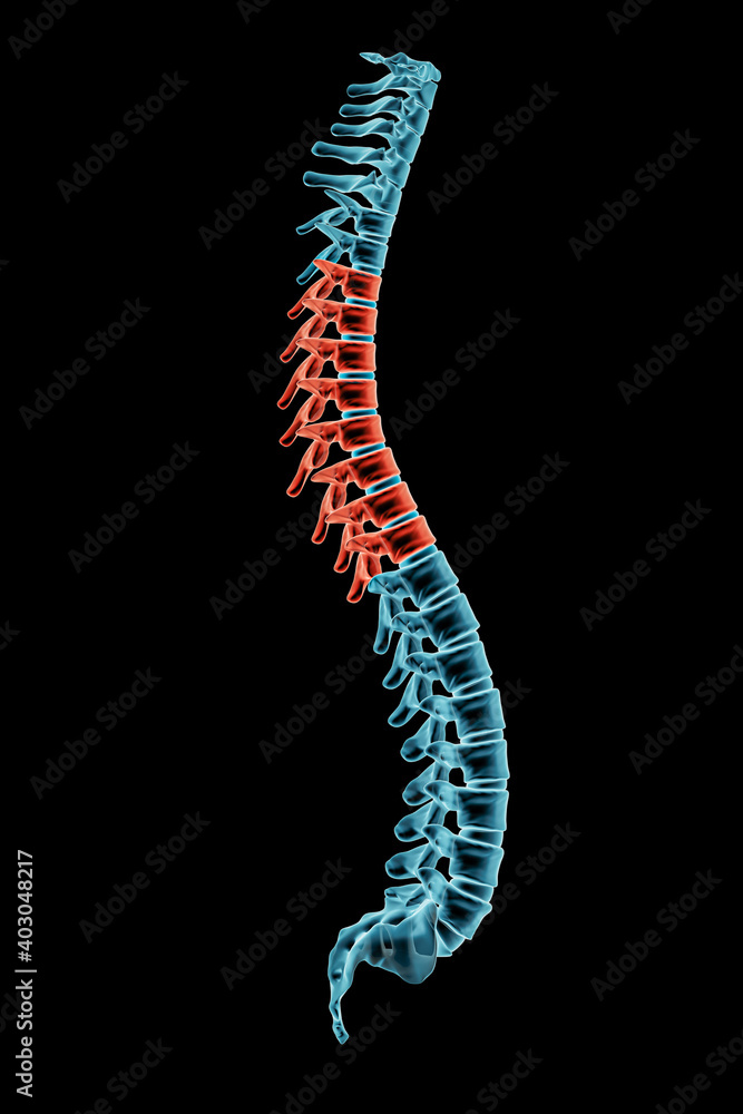 X-ray spinal column with kyphosis posture and pathological vertebrae highlighted in red. Human curvature of the spine disorder 3D rendering illustration. X-ray spinal column with kyphosis posture and pathological vertebrae highlighted in red. Human curvature of the spine disorder 3D rendering illustration.