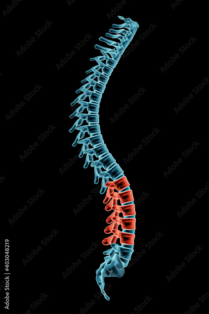 X-ray spinal column with lordosis posture and pathological vertebrae highlighted in red. Human curvature of the spine disorder 3D rendering illustration. X-ray spinal column with lordosis posture and pathological vertebrae highlighted in red. Human curvature of the spine disorder 3D rendering illustration.