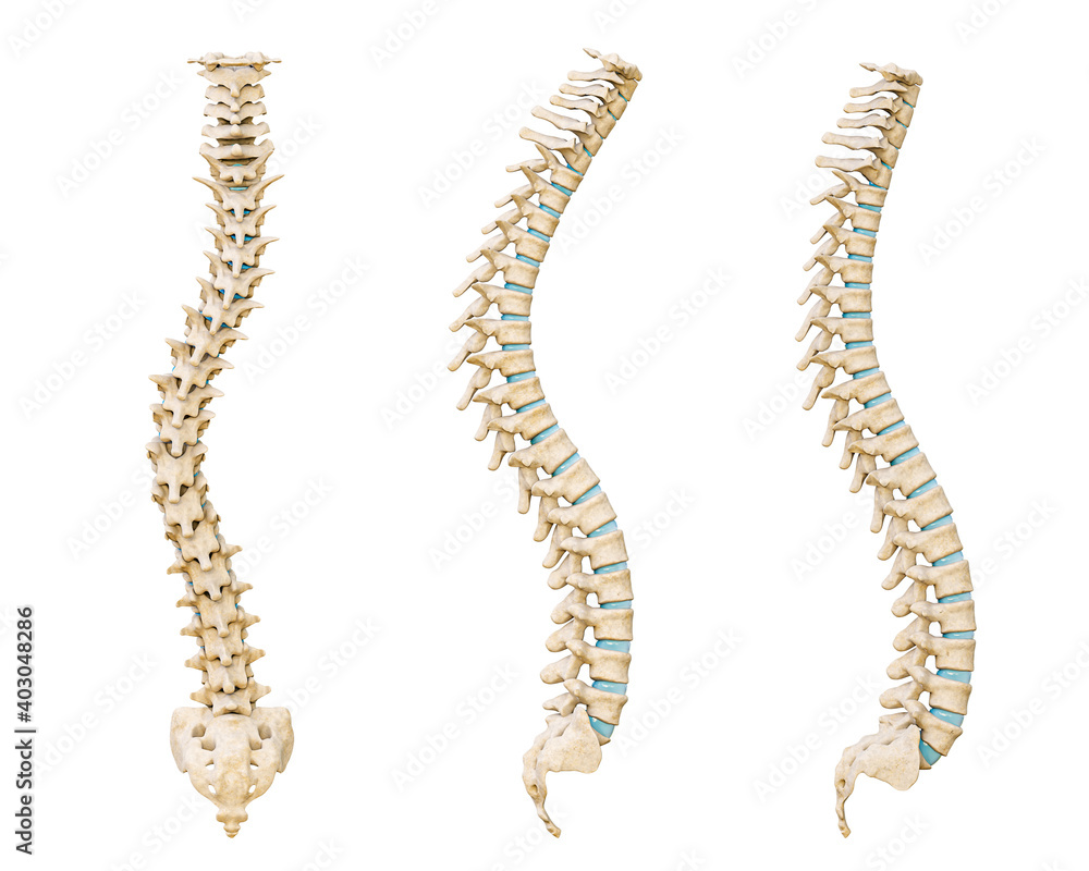 Common spinal disorders 3D rendering illustration isolated on white background. Scoliosis, lordosis and kyphosis curvature of the spine. Medical and healthcare, human anatomy, medicine concept. Common spinal disorders 3D rendering illustration isolated on white background. Scoliosis, lordosis and kyphosis curvature of the spine. Medical and healthcare, human anatomy, medicine concept.