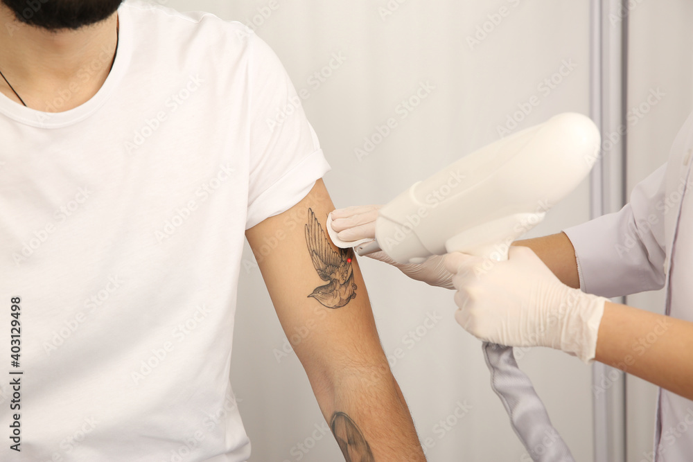 Fototapeta premium Young man undergoing laser tattoo removal procedure in salon, closeup