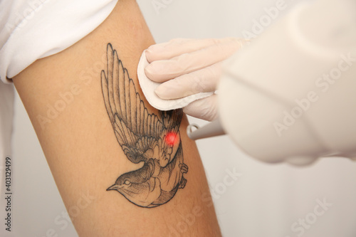Photos Young man undergoing laser tattoo removal procedure in salon, closeup