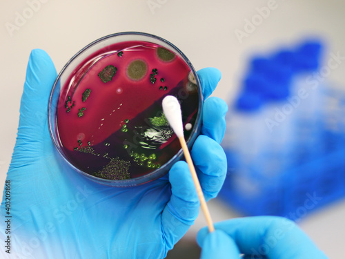 Scientist analysis Escherichia coli (E.coli) culture with Eosin Methylene Blue (EMB) Agar in Petri dish show the metallic green sheen colonies, hold in hands with nitrile gloves with swab test cotton.
