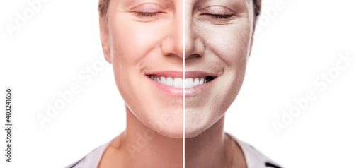 A woman's face is split in half for good and bad skin. Isolated on white background.