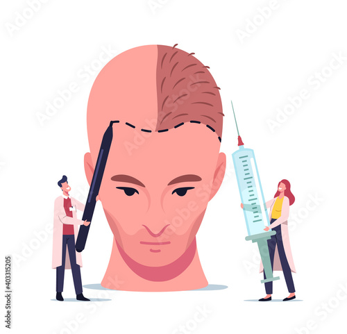 Hair Loss and Receding Health Problem. Tiny Doctor Characters Prepare Huge Male Head for Hair Transplantation Procedure