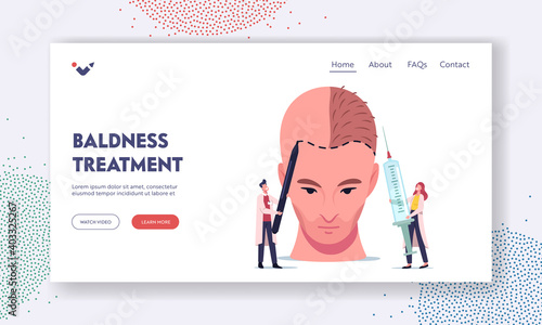 Hair Loss and Receding Landing Page Template. Tiny Doctor Characters Prepare Huge Male Head for Hair Transplantation