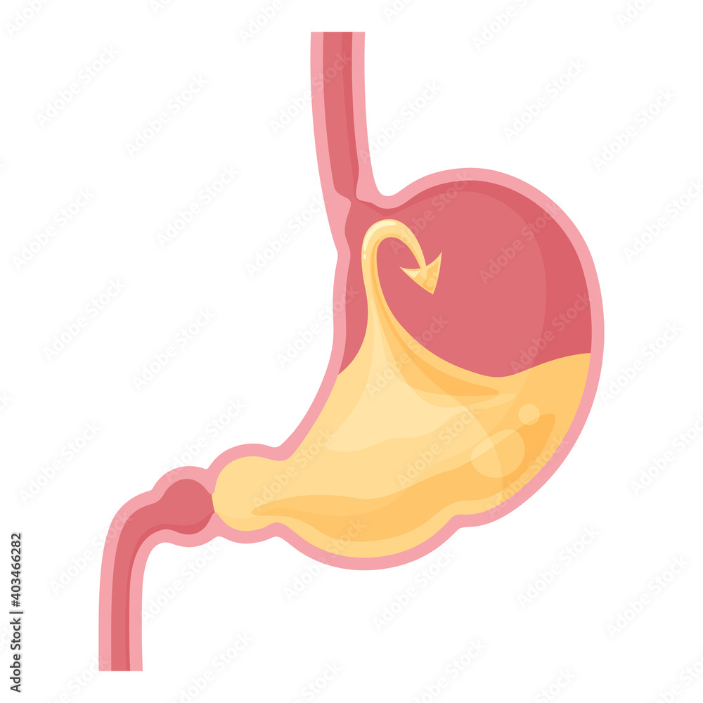 Obraz premium 下部食道括約筋が働いて胃酸が逆流しないよ