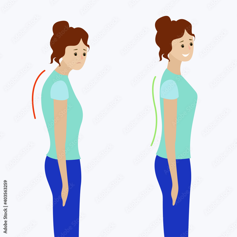 Two girls with a straight and curved spine Two girls with a straight and curved spine