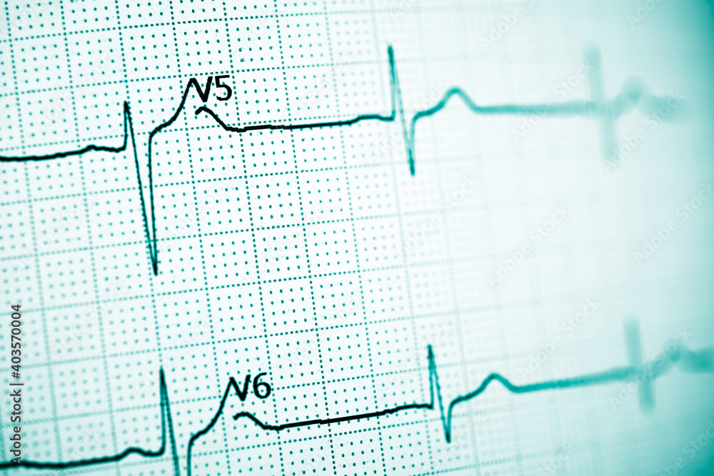 Electrocardiograph closeup view Electrocardiograph closeup view