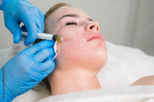 PRP therapy in beauty clinic. Cosmetologist is doing injections of blood plasma to womans face to cure problem skin, closeup top view. Treatment of skin in cosmetology for young female. photo