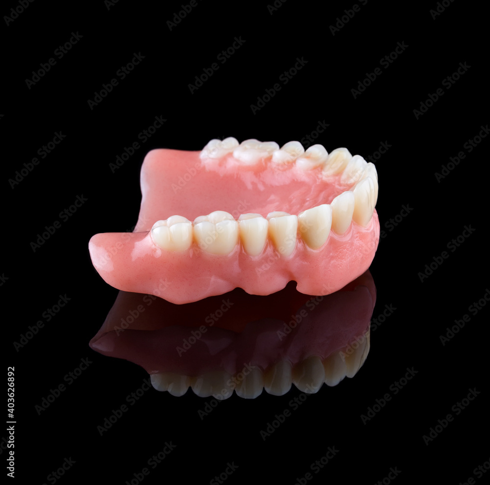 Complete maxillary denture Complete maxillary denture