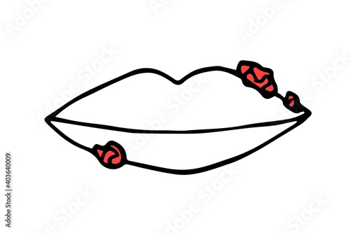 Simple vector black outline drawing. Herpes on the lips, viral fungal disease, colds, inflammation, skin rash. Medicine and health.