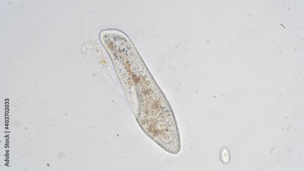 Paramecium caudatum is a genus of unicellular ciliated protozoan and Bacterium under the microscope Paramecium caudatum is a genus of unicellular ciliated protozoan and Bacterium under the microscope