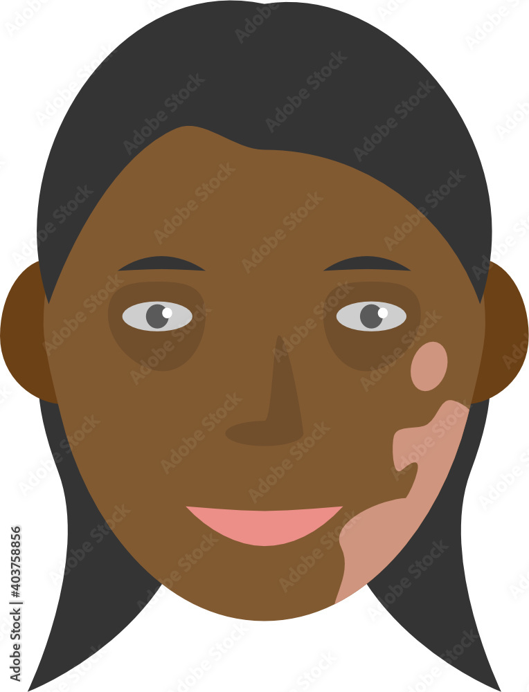 Human face with pigment birthmark long hair vector graphic clipart ...