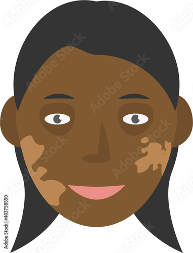 Human face with pigment birthmark long hair vector graphic clipart illustration or icon isolated