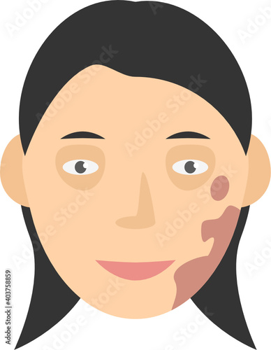 Human face with pigment birthmark long hair vector graphic clipart illustration or icon isolated