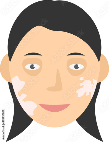 Human face with pigment birthmark long hair vector graphic clipart illustration or icon isolated