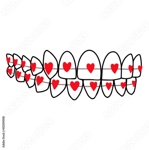 Orthodontic treatment braces system on teeth from hearts u dentistry logo. Vector Illustration. Poster for dentist, orthodontist. Result after using bracket system.