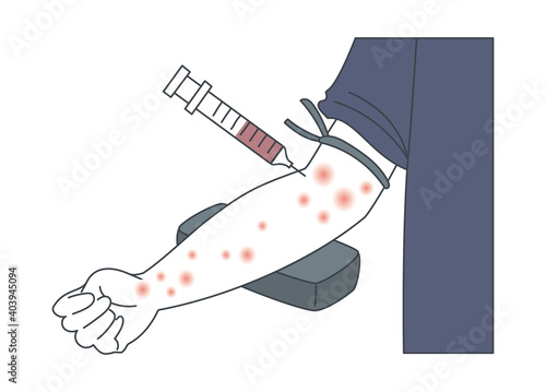 湿疹・アレルギー・血液検査するイラスト