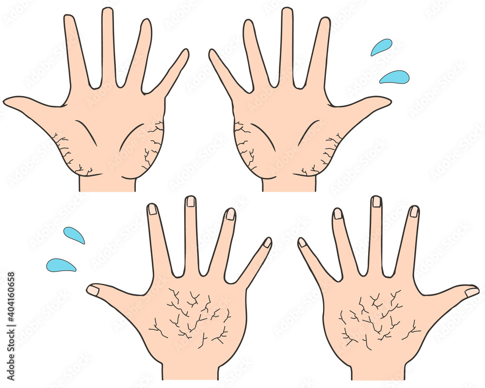 Obraz premium 手 ひび割れ