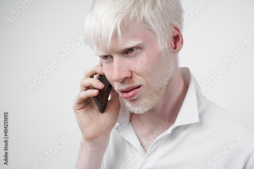 albinism albino man in studio dressed t-shirt isolated on a white background. abnormal deviations. unusual appearance © Andrii