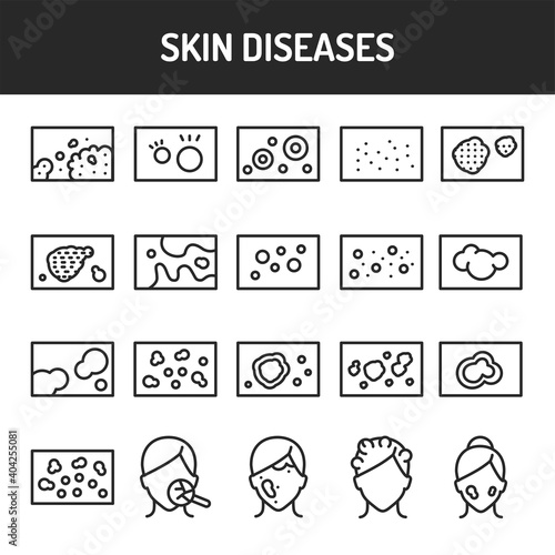 Skin diseases black line icons set. Isolated vector element. Outline pictograms for web page, mobile app, promo