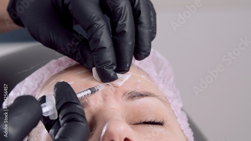 Doctor's hands in black gloves makes cosmetic injections into the face of a young woman. Female doctor wipes the patient's forehead with a cotton napkin after the injection. Close up