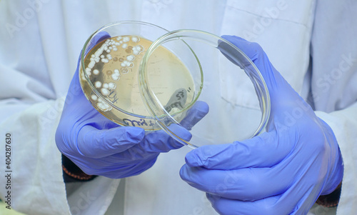 A scientist shows bacteria in a Petri dish to the camera, sliding the lid halfway to the side, close-up. photo