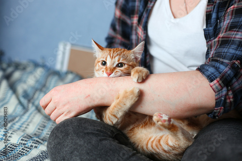 Young domestic red cat bites woman's hand. Blue bed. Day light