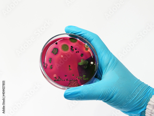 Bild auf Leinwand Scientist test Escherichia coli (E