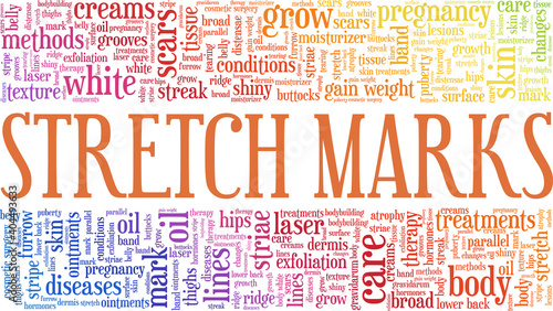 Stretch marks vector illustration word cloud isolated on a white background.	