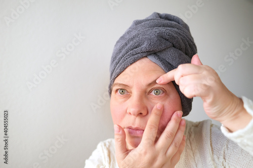 Quadro em tela face of a European adult woman close up, wrinkles on the aging skin, makes a lif