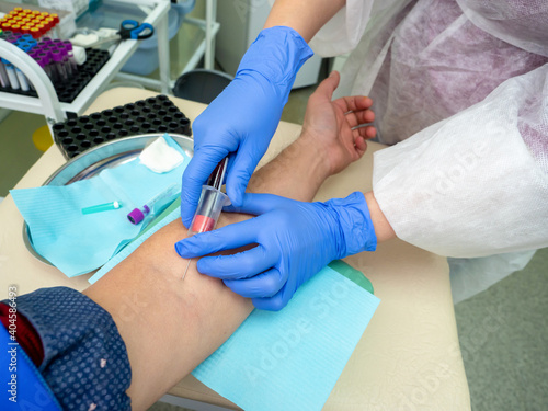 A Nurse In The Clinic Inserts A Catheter Into A Vein For Blood Testing For A man. blue medical gloves. close up.