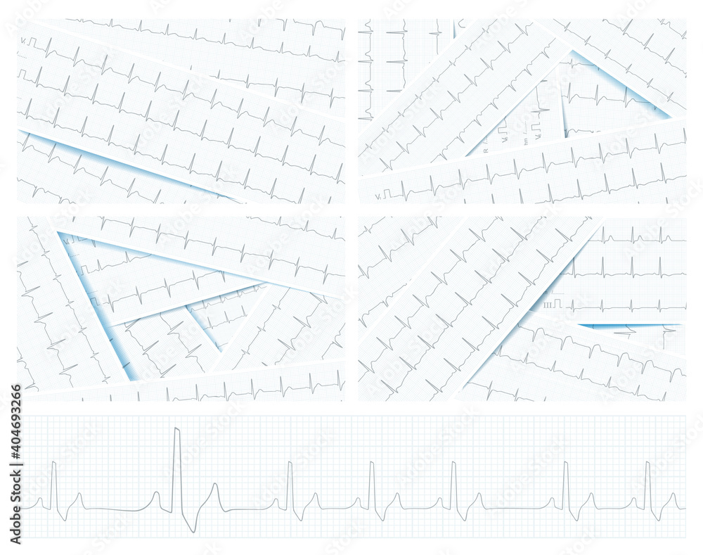 Scattered ECG charts as a healthcare background, vector Scattered ECG charts as a healthcare background, vector