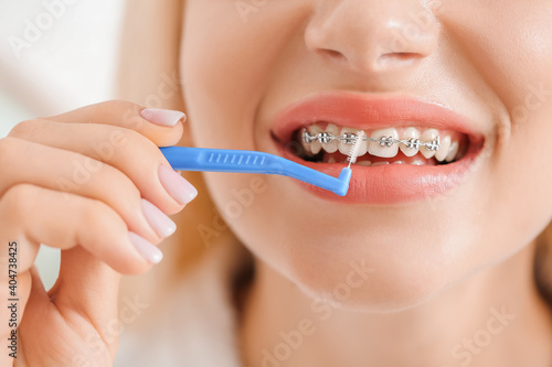 Young woman with dental braces and toothbrush on light background