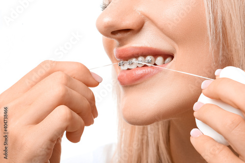 Young woman with dental braces and floss on white background
