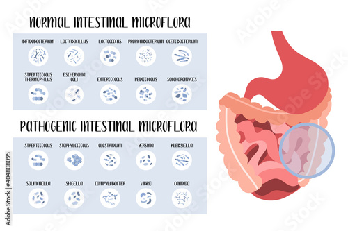 Intestinal microflora. Normal and pathogenic bacteria for stomach, gut, intestine. Good and bad microorganism. Microbiome. Vector flat cartoon illustration. Perfect for flyer, medical brochure, banner