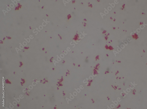 Gram negative diplococi bacteria Neisseria spp. photo