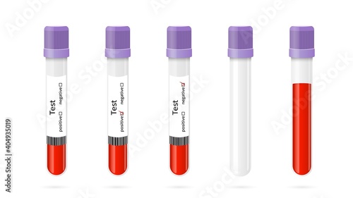Test tubes with blood clipart. Medical testing for coronavirus filled plastic containers with purple caps positive and negative results full red plasma and clear vector glass.