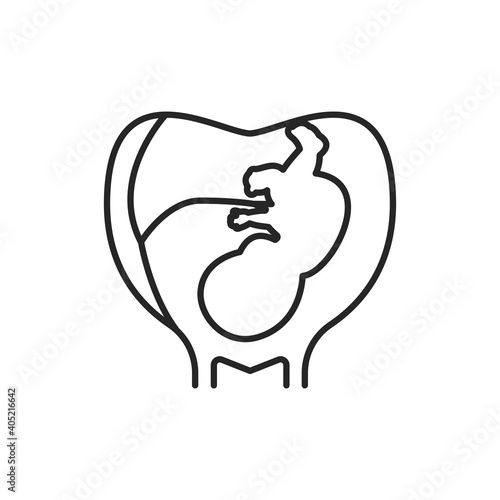 Pregnancy stage embryo in uterus with umbilical cord black line icon. Growth fetus development. Pictogram for web page, mobile app. UI UX GUI design element. Editable stroke.