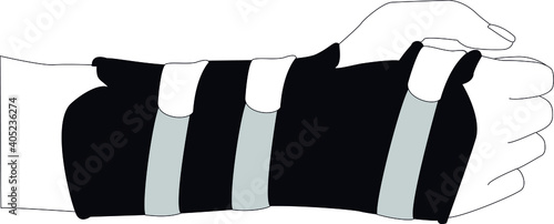 muñequera ortopédica en la mano derecha. Ilustración 3 colores (blanco, negro, gris). photo