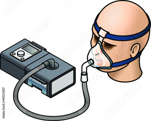A CPAP (continuous positive air pressure) machine used in the treatment of sleep apnoea. Shown with a mask fitted over a head.