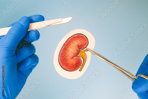 operation on human kidney