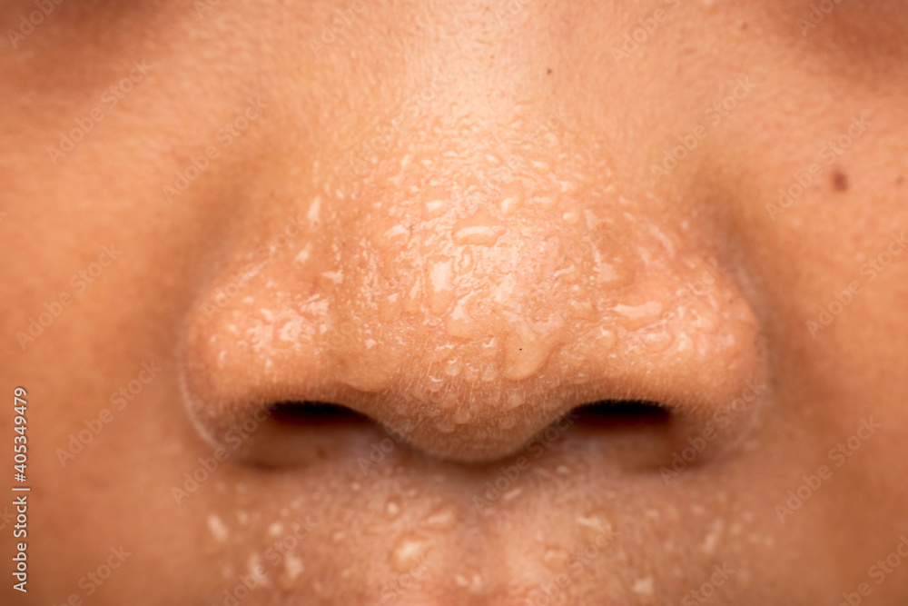 Sweating on the nose and face.Close up face with sweat ware drop on face.