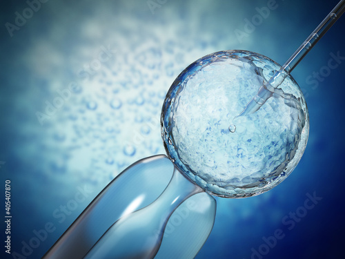 3D illustration of artificial insemination process showings sperms being injected inside the ovule. 3D illustration
