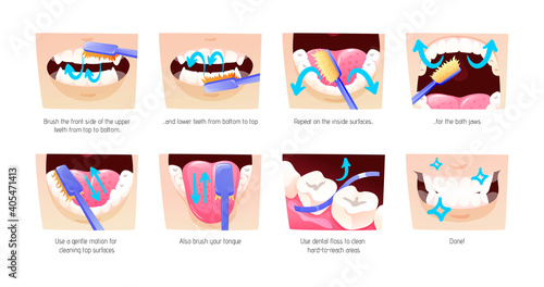 Step-by-step scheme, instructions on how to brush your teeth properly. Infographics toothbrush, toothpaste for oral hygiene. Clean healthy, white teeth, healthy lifestyle, dental care cartoon