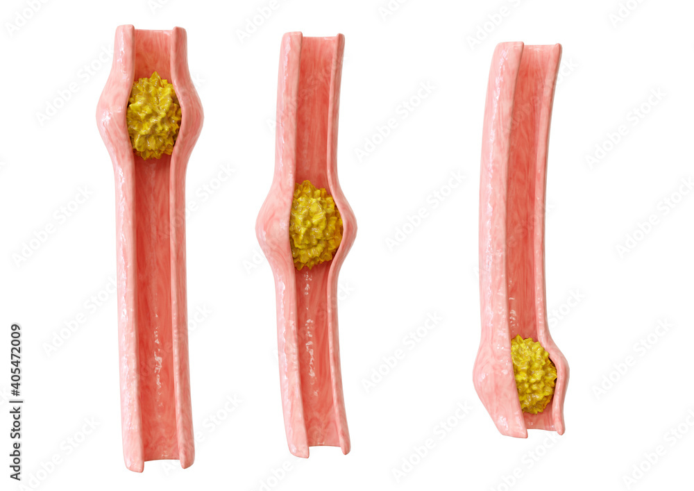 Illustrazione Stock peristalsis is the contraction of the muscles of