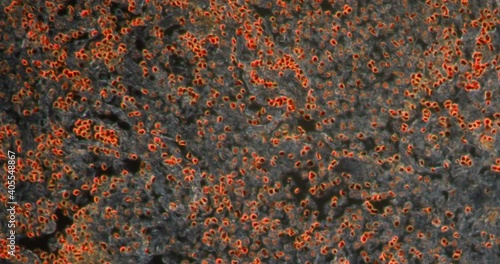 lung AIDS fungi tissue in Darkfield tissue under the microscope 200x photo