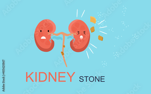 Kidney Stone concept. Cute kawaii human organ is attacked by sodium salt.Nephrology.Pyelonephritis and renal failure disease.Cystitis chronic illness.Problem with filtration,dialysis.Vector.Drink more