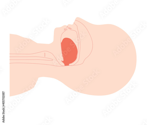 睡眠時無呼吸症候群　舌が下がっているイラスト