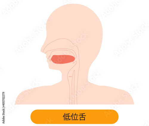 低位舌のイラスト